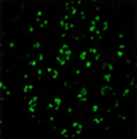 CD3 (T Cells)