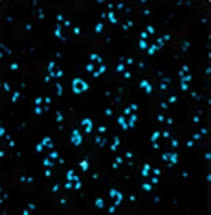 CD68 (Macrophages)