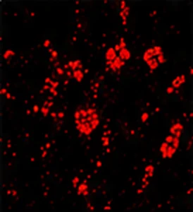 CD8(細胞毒 T 細胞)