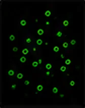 CD19 (B Cells)