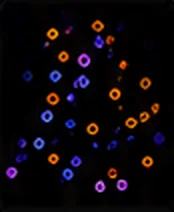 κ / λ Light Chain Restriction