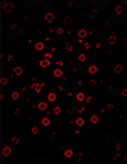 CD25(IL-2Rα)