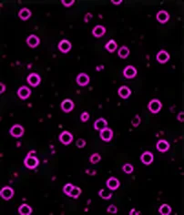 CD90 (Positive)