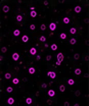 CD44 (CSC)
