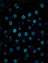ALDH1 (CSC)