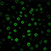 CD3 (T Cells)