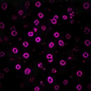 CD56 (NK Cells)
