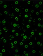 CD11c (Myeloid DCs)
