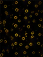 CD141 (mDC1)