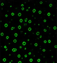 CD3 (T Cell)