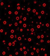 CD19 (B Cell)