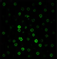 GFAP (Astrocytes)