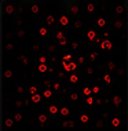CD11b (Microglia)