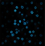 MAP2 (Neurons)