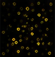 MBP (Oligodendrocytes)