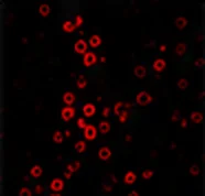 CD11b(小膠質細胞)